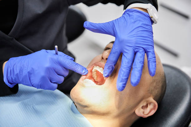 Teeth Whitening in IL